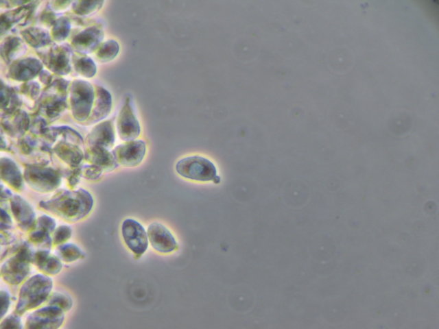 Botryobasidium con spore finemente verrucose